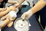 Bé trai 16 tháng tuổi tím tái, suy hô hấp vì hóc hạt chôm chôm