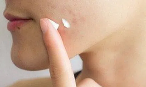 Thu hồi 5 sản phẩm mỹ phẩm của Công ty Kencare Việt Nam