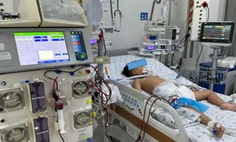 Thay huyết tương cứu sống bé trai 4,5 tuổi ngộ độc paracetamol nặng