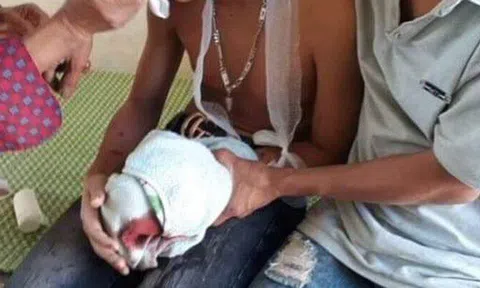 Hà Tĩnh: Laptop phát nổ khi sạc, 3 học sinh lớp 9 nhập viện cấp cứu