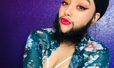 Nữ người mẫu có râu: 'Tôi nghĩ mình gợi cảm'