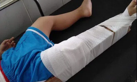 Cô giáo bị đình chỉ dạy học vì làm gãy chân trẻ 3 tuổi