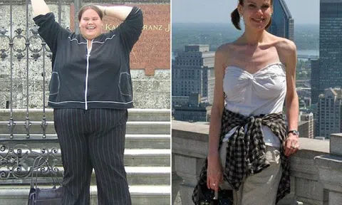 Giảm 140kg mỡ thừa, cô gái phải hối hận cả đời